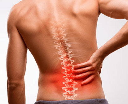 5 Señales de que tu dolor de espalda podría ser una hernia discal
