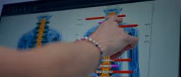MyoVision Scan (Tecnología sEMG)